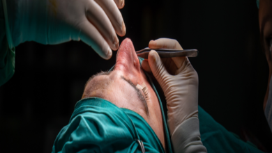 What to Ask Your Specialist About Open Septorhinoplasty and Preservation Rhinoplasty in London