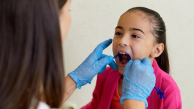 What to Prepare Before Booking Tongue Tie Surgery and Sialendoscopy in London
